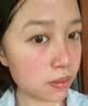 老中医修护面霜去呵护红血丝修复角质层薄皮肤屏障受损泛红敏感肌护肤品 老中医舒颜修护素30g 实拍图