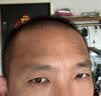 Dr.HillGod烟酰胺祛斑美白淡化黑色素沉淀去除黑棘皮淡化祛痘印儿童腋下脖子 实拍图