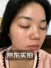 川廿制药烟酰胺凝胶精华液祛斑美白淡化黑色素医用男女士专用搭熊果苷乳膏 实拍图