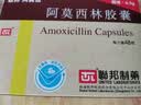 [阿莫仙] 阿莫西林胶囊0.5g*48粒/盒 实拍图