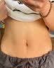 ELSIEDOCTOR妊娠纹产后修复霜祛疤膏祛疤痕修复凝胶肥胖纹生长纹专用非药 实拍图