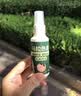 祥醫堂马拉色菌专用毛囊喷雾头皮部毛囊炎痒有红疙瘩前胸后背除螨痘 实拍图