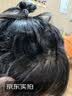 淞町制药百部酊喷雾剂去头虱虱子药儿童除跳蚤阴虱男士私处专用虫卵一扫光 实拍图
