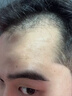 霸王防脱去屑洗发水何首乌防脱发洗头膏控油蓬松男女士洗发露1L 实拍图