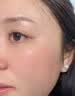熊果苷乳膏去黑眼圈脸部去斑去除黑色素医熬夜眼霜复方男女士 1盒熊果苷乳膏 【尝试装】 实拍图