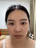 金茉（GEMO）【瞬时提拉】二代抗衰美容仪奢华冰提拉紧致v脸美白促渗淡斑生日七夕礼物送老婆妈妈G20E 实拍图