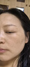 玉兰油（OLAY）第4代淡斑小白瓶40ml面部精华液ProX祛痘印美白烟酰胺生日礼物女 实拍图