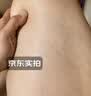 霍悉医生（DR HAWCISLN）静脉曲张专用蚯蚓腿疏通血管精索冷敷凝胶可搭二级弹力袜子非膏药 实拍图