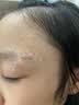 诗丽莎硅酮疤痕凝胶祛疤膏修护儿童成人创伤烧烫剖腹产增生凸起手术 ３盒装【买2送同款1支】活性修护-适用任何疤痕 实拍图