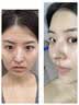OHBT面膜美白淡斑补水保湿男女士熬夜舒缓抗皱紧致去黄气暗沉提亮肤色 实拍图