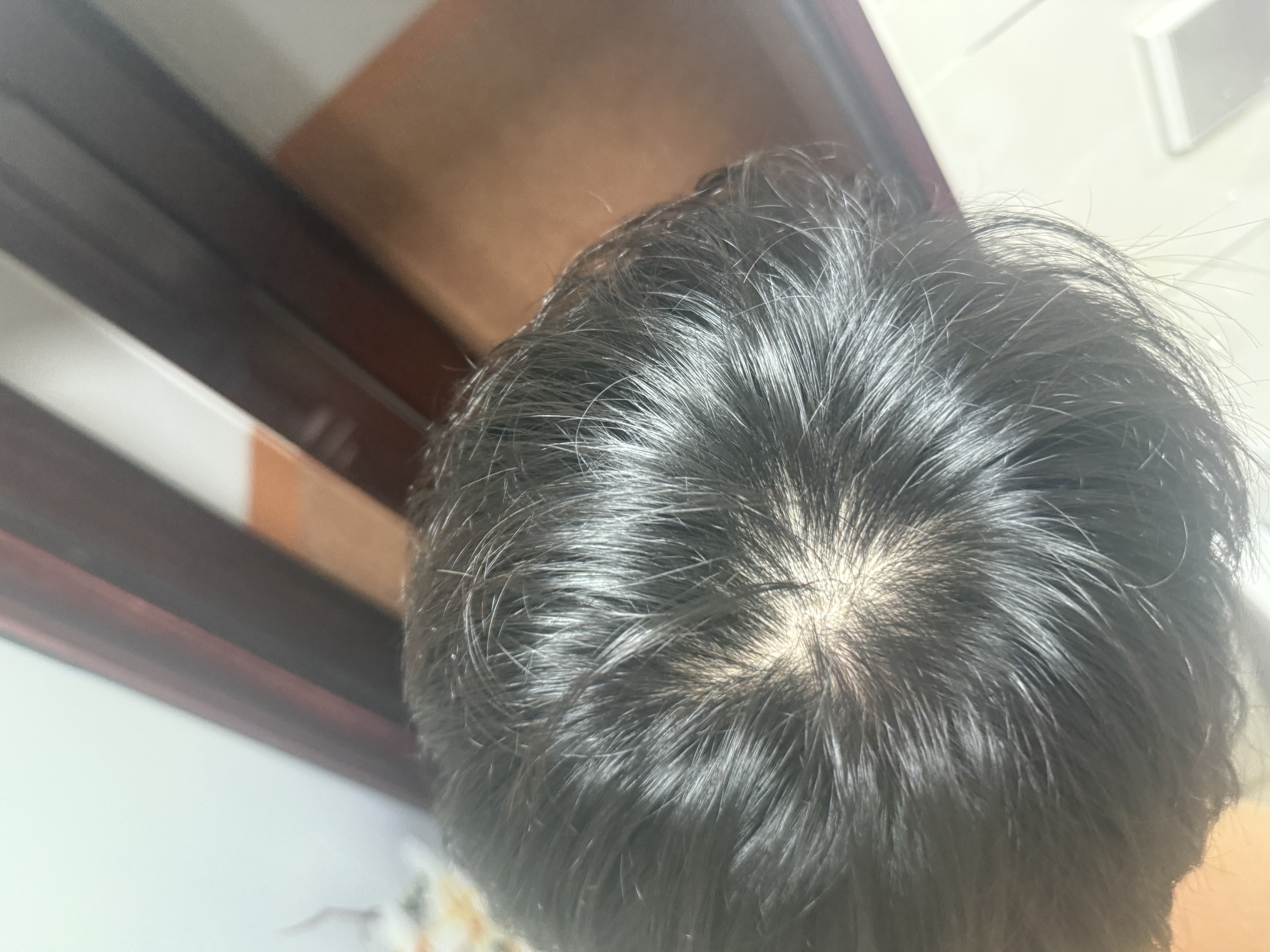 蔓迪【二代米诺地尔】蔓迪5%生发泡沫剂60g(倍速温和生发)+蔓迪泡沫涂抹器 (精准款)1个 实拍图