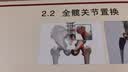 雅德助行器老人专用出行康复辅助行走器可折叠代步车 实拍图