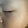 BKWILD医用重组生长因子凝胶胶原蛋白点痣喷人表祛疤痕膏修复生肌膏 实拍图