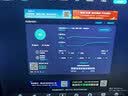 中兴（ZTE）F40 5G RedCap随身wifi6免插卡轻量化5G移动wifi无线网便携路由器热点笔记本电脑上网流量2026款 实拍图