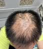 DR.SOKK生发液激活毛囊增发密发长发剂育发液固发液防脱发严重男女士专用 实拍图