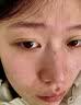 婴儿油收缩毛孔精华液去黑头深层清洁毛孔粉刺按摩保湿正品滋润油 100ml1瓶【婴儿椰子油】收缩毛孔 实拍图