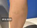 霍悉医生（DR HAWCISLN）静脉曲张专用蚯蚓腿疏通血管精索冷敷凝胶可搭二级弹力袜子非膏药 实拍图