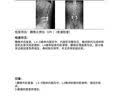 ZEAMO医用腰托护腰带腰部支撑腰肌劳损腰椎间盘突出男女士专用腰围护腰 实拍图