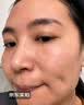 YYTISS熊果苷乳膏去斑去黑色素祛斑美白淡斑提亮去黄改善暗沉肤色医美用 实拍图