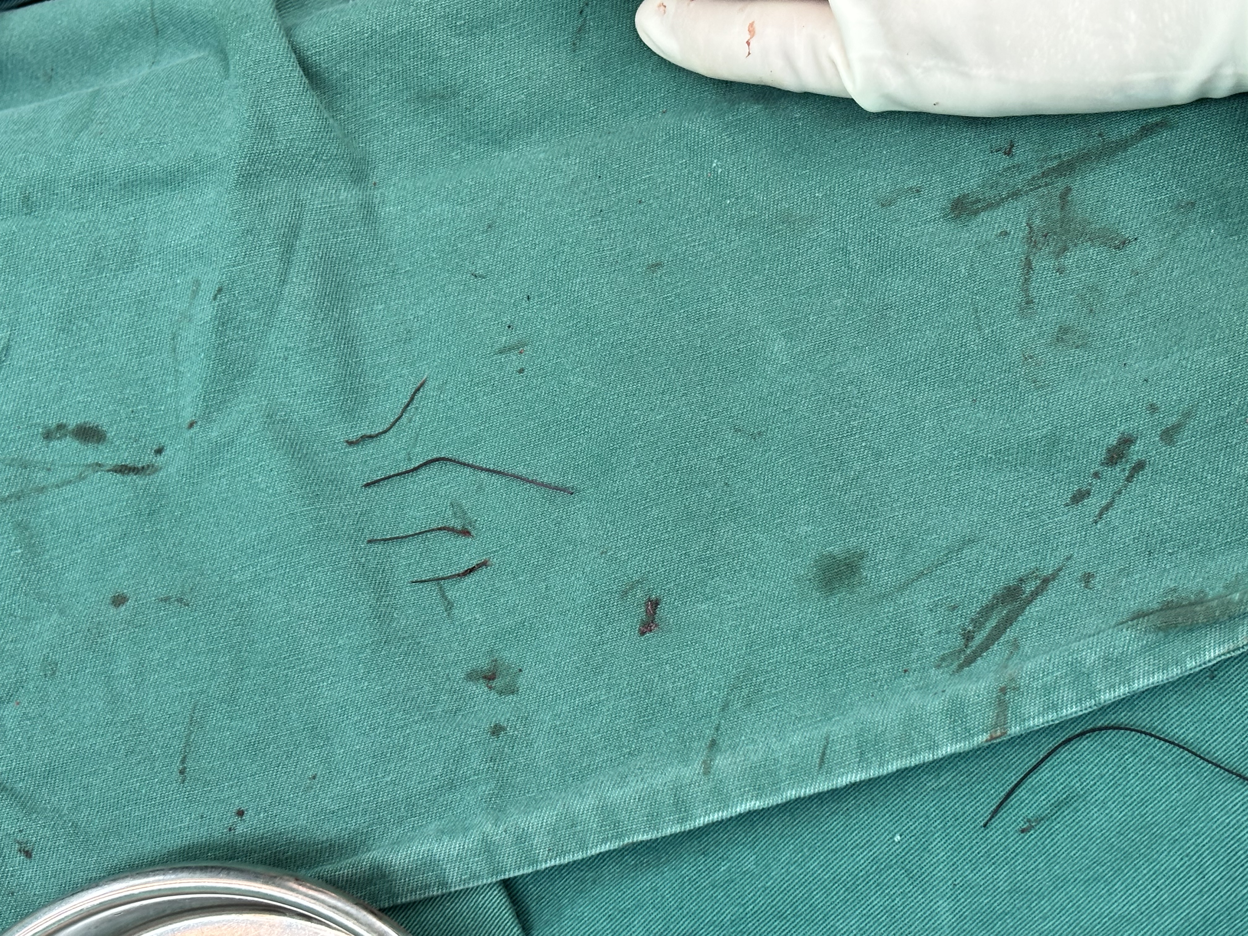 沃朗森医用口腔护理脱敏膏牙膏状抗敏感抗过敏护龈冷热酸甜牙齿松动专用酸痛消炎出血牙龈肿痛怕刺激成年人含氟防蛀 实拍图