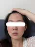 维特丝377面霜乳液男女士美白祛斑紧致高保湿补水去黄提亮黑色素护肤品 实拍图