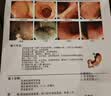 【原研进口】莎尔福 美沙拉秦肠溶片 0.5g*40片/盒*3盒 实拍图