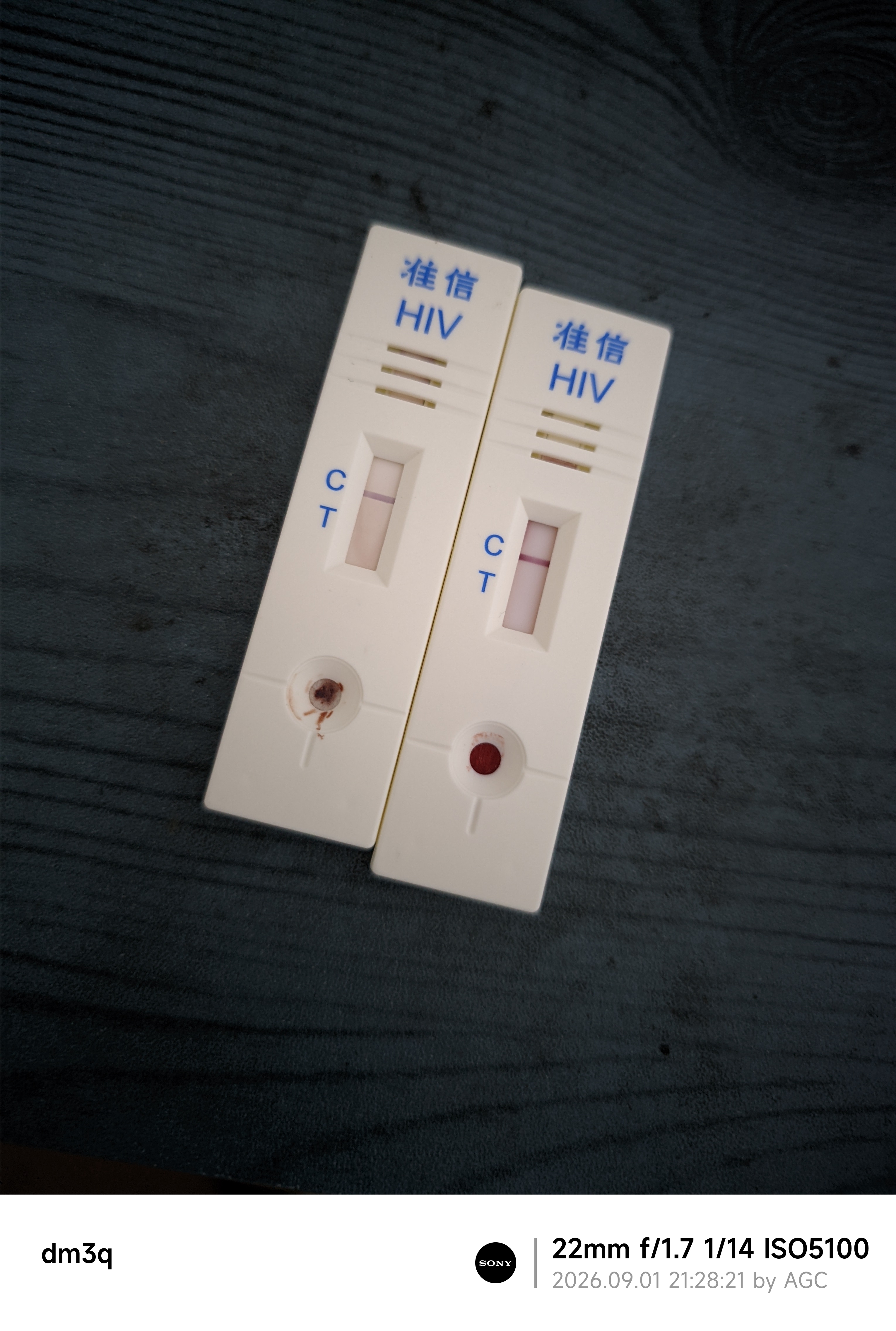 准信（Accu News）艾滋病检测试纸 hiv试纸性病血液抗体传染病自检测试剂盒 1盒装 实拍图