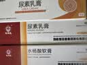 马应龙尿素乳膏10%20g/盒 尿素软膏尿素霜医用尿素乳膏手脚干裂干燥手足皲裂脚后跟干裂膏角化型脚气 实拍图