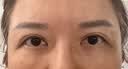 Tripollar【双11正式开抢】初普美眼仪眼部大排灯黑眼圈眼纹去眼袋美容仪眼霜家用神器生日礼物女价保双十一 实拍图
