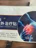 九芝堂远红外治疗贴肩周炎肩膀疼痛肩周劳损抬臂困难僵硬膏药贴 6贴*5盒 实拍图