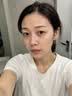 维特丝洗面奶男女士氨基酸美白淡斑提亮肤色控油收缩毛孔深层清洁黑头角 实拍图