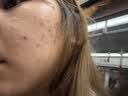 敷尔佳医用重组III型人源化胶原蛋白贴绿膜1盒面膜状医美术后屏障护理 实拍图