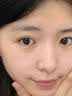 OHBT面膜美白淡斑补水保湿男女士熬夜舒缓抗皱紧致去黄气暗沉提亮肤色 实拍图