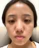 羽藤制药日本进口成分医美用烟酰胺凝胶祛斑美白淡化黑色素脸部军训专用1 实拍图