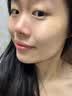 羽藤制药日本进口成分医美用烟酰胺凝胶祛斑美白淡化黑色素脸部军训专用3 实拍图