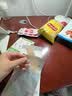 美皮护疤痕贴硅酮祛疤瑞典【双眼皮】2.5X10cm【全网低价】祛疤贴 实拍图