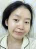 优理氏 寡肽冻干粉精华液祛痘淡化痘印痘坑毛孔收缩次抛男女士修护粉刺 实拍图