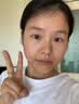 澳白汀（OHBT）氨甲环酸精华液传明酸湿敷原液医美祛斑改善暗沉黄褐斑专用50ml 实拍图