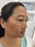 EDRI氨甲环酸祛斑乳膏医美用祛斑霜美白淡化黑色素黄褐斑雀斑晒斑男女 实拍图