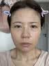 OHBT胶原蛋白面膜抗皱紧致抗衰老补水美淡白斑去黄气暗沉提亮肤色男女 实拍图