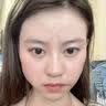 透真水杨酸面膜去黑头闭口粉刺祛痘青少年淡化痘印修复保湿补水男女士 实拍图