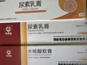马应龙尿素乳膏10%20g/盒 尿素软膏尿素霜医用尿素乳膏手脚干裂干燥手足皲裂脚后跟干裂膏角化型脚气 实拍图