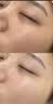华美科医用重组人体表皮生长因子点痣疤痕修复凝胶烫软膏伤口愈合15g1支 实拍图