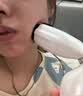 金茉（GEMO）【林允同款水光】AI智能水光仪大师手打仪器抗衰胶原复配水光针原液自打生日节日礼物送女友W20AI 实拍图