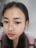高坂制药点痣膏点斑祛疣药水脸部去黑痣扁平跖疣修复液无痕不留疤非药5ml 实拍图