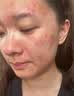 维特丝芦荟胶补水保湿晒后修复凝胶面霜祛痘印收缩毛孔烟酰胺男女士 实拍图