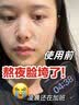 Newliann30支医用重组胶原蛋白次抛精华液抗皱紧致淡斑补水修复皮肤屏障 实拍图