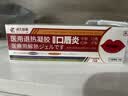 藤久唇炎唇膏嘴唇干裂嘴干起皮唇炎膏保湿滋润防干裂脱皮医用退热凝胶 实拍图