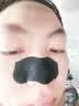sakose凡士林男士去黑头鼻贴10片祛粉刺神撕拉面膜器清洁收缩毛孔 实拍图