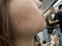 敷尔佳医用重组III型人源化胶原蛋白贴绿膜1盒面膜状医美术后屏障护理 实拍图